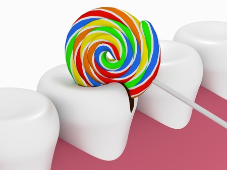 Problem of hygiene of the oral cavity, harm of sweet and cariesの写真素材