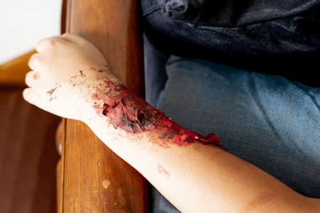 red bloody nasty cut on a hand of a child.の写真素材