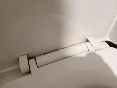 Close up dirty white toilet seat with mold.の写真素材