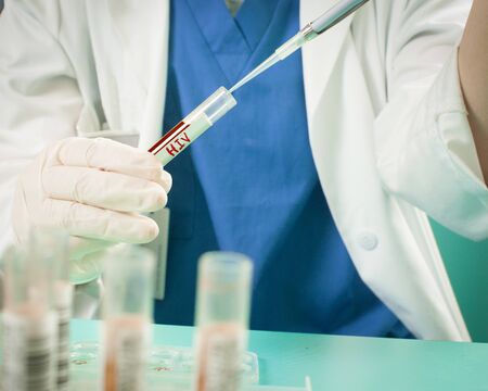 specialist make a hiv test, aids test in the laboratory