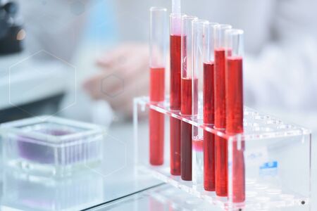 Concept Coronavirus.  scientist or doctor research for Corona virus treatment drug And research in...