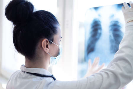 Pulmonologist looking at lung x-ray prescribing treatment to patient, healthcareの写真素材
