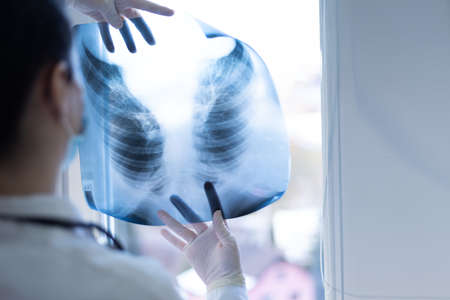 Pulmonologist looking at lung x-ray prescribing treatment to patient, healthcareの写真素材