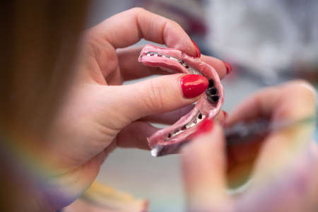 Dental prosthesis, dentures, prosthetics work. A study and a table with dental tools