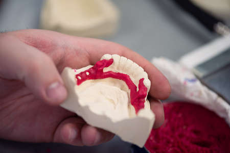 Dental prosthesis, dentures, prosthetics work. A study and a table with dental toolsの写真素材