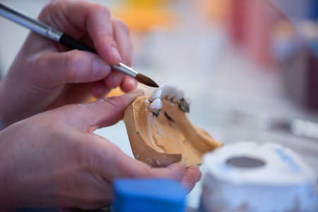 Dental prosthesis, dentures, prosthetics work. A study and a table with dental toolsの写真素材