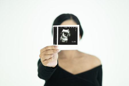 Young woman shows ultrasound image of her baby, focus on ultrasound imageの写真素材