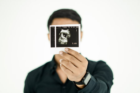 Young Man show ultrasound image of his baby, focus on ultrasound imageの写真素材