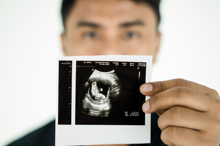 Young Man show ultrasound image of his baby, focus on ultrasound image