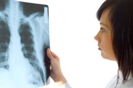 Female doctor looking at x-ray image on white