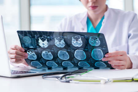 Doctor examining MRI image in hospital