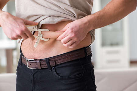 Man measuring body fat with calipersの写真素材