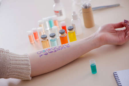 Doctor testing allergy reaction of patient in hospitalの写真素材