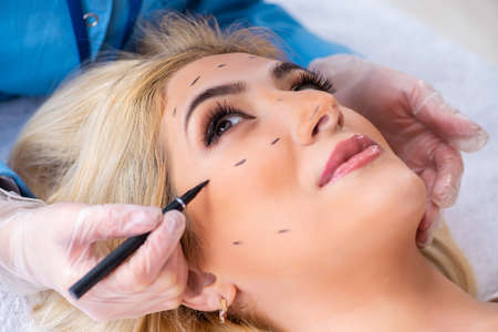 Woman getting ready for plastic surgeryの写真素材