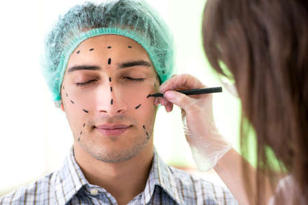 Plastic surgeon preparing for operation on man faceの写真素材