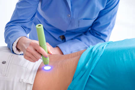 Patient in clinic undergoing laser scar removalの写真素材