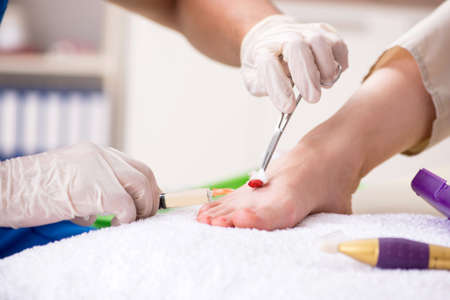 Podiatrist treating feet during procedureの写真素材