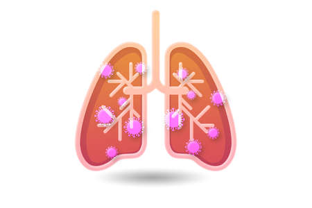 Illustration of lungs infected with coronavirusの写真素材