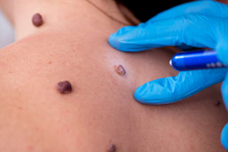 Young woman visiting doctor dermatologistの写真素材