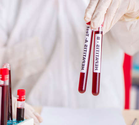 Young handsome lab assistant testing blood samples in hospitalの写真素材