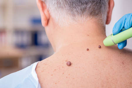 Old man visiting young male doctor dermatologistの写真素材