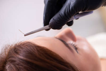 Young woman visiting beautician in hair transplantation conceptの写真素材