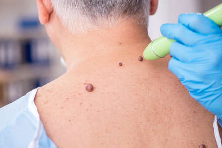 Old man visiting young male doctor dermatologistの写真素材
