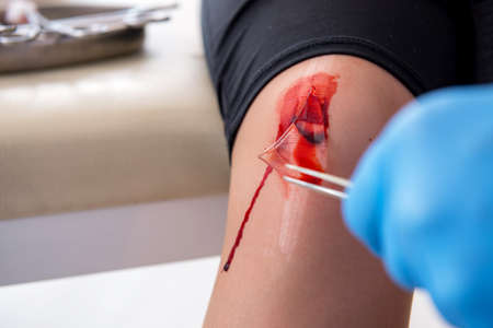 Leg injured woman visiting male doctorの写真素材