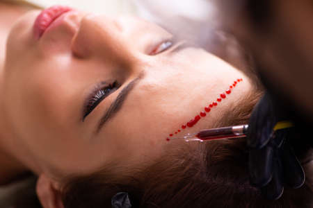 Young woman visiting male beautician in hair transplantation conの写真素材