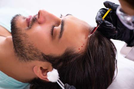 Young man visiting female beautician in hair transplantation conの写真素材