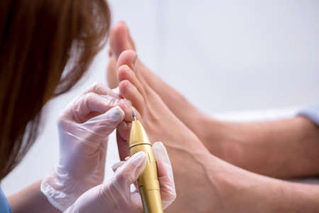 Podiatrist treating feet during procedureの写真素材