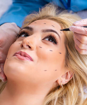 Woman getting ready for plastic surgeryの写真素材