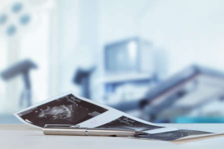 Medical abstract still life with sonogram and penの写真素材