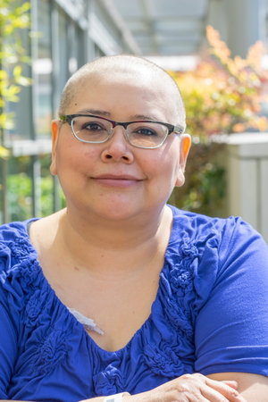 Hispanic woman with breast cancer learns to deal with hair loss