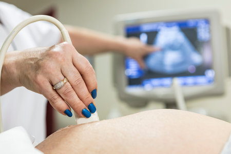 In the Hospital, Close-up Shot of the Doctor does Ultrasound / Sonogram Procedure to a Pregnant...