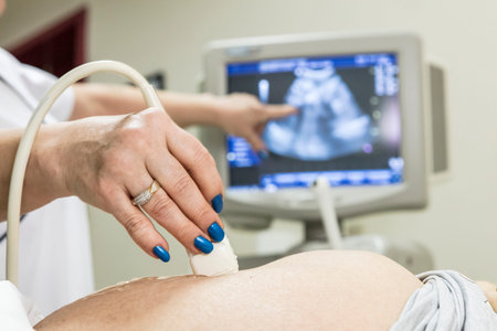 In the Hospital, Close-up Shot of the Doctor does Ultrasound / Sonogram Procedure to a Pregnant...