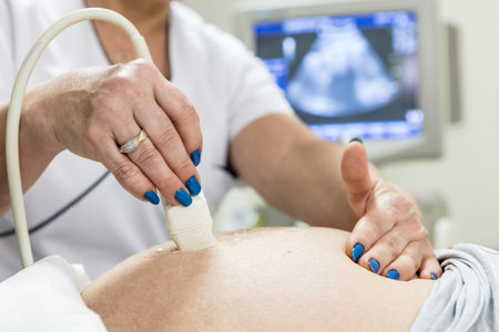 In the Hospital, Close-up Shot of the Doctor does Ultrasound / Sonogram Procedure to a Pregnant Woman. Obstetrician Moving Transducer on the Belly of the Future Mother.の写真素材