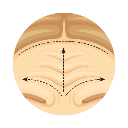 Cosmetic surgery on female forehead with dotted lines. Plastic surgery vector illustrationのイラスト素材