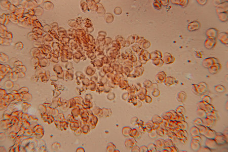 Close-up of red blood cells under microscope, highlighting their distinct shapes and textures, set...