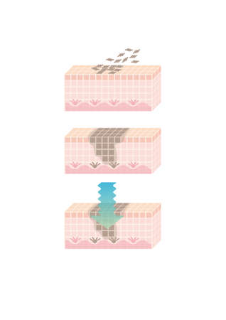 Skin dermis layerのイラスト素材