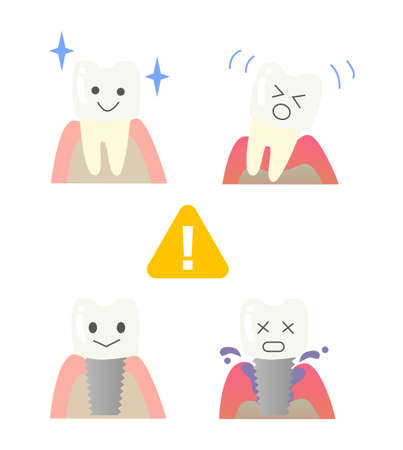 tooth implantのイラスト素材