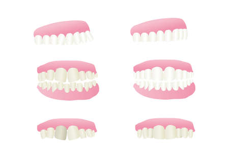 teeth and gumのイラスト素材
