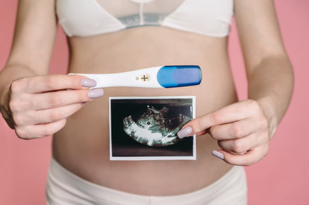 A happy expectant mother shows an ultrasound image of the fetus on camera. Prenatal ultrasound screening. close-up of the abdomen of a young pregnant woman holding a sonogram and test of an unborn child.の写真素材