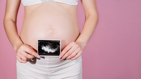 A happy expectant mother shows an ultrasound image of the fetus on camera. Prenatal ultrasound screening. close-up of the abdomen of a young pregnant woman holding a sonogram of an unborn child. A place for your text.の写真素材