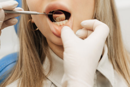 close-up. The dentist examines the patients teeth.の写真素材