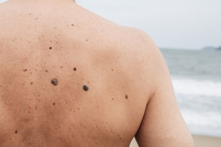 The back of an elderly man with freckles, aging spots, black, brown warts and wrinkles against the background of the seaの写真素材