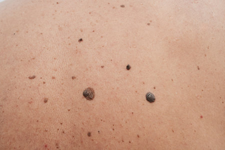 Human skin with freckles, aging spots, black and brown moles, wrinklesの写真素材