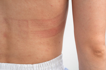 Bra marks on the back. The person rubbed their back with their underwear. Uncomfortable bra. The wrong size underwear. Traces of clothing on the body.の写真素材