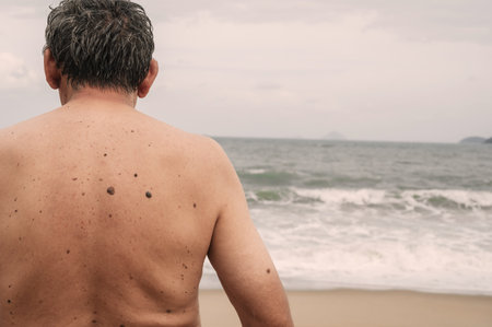 The back of an elderly man with freckles, aging spots, black, brown warts and wrinkles against the background of the seaの写真素材