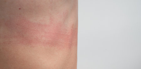 Panoramic view of the bra marks on the female body. An uncomfortable bra. Traces of clothing on the body. Body positivity and self-love.の写真素材